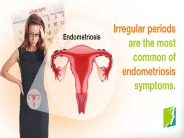 Irregular Menstrual Period