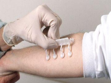 Tests and diagnosis
