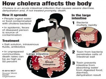 Cholera