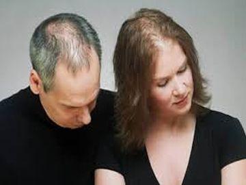 Hair Loss