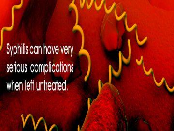 Syphilis