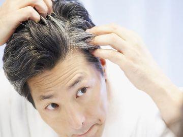 Graying of Hair