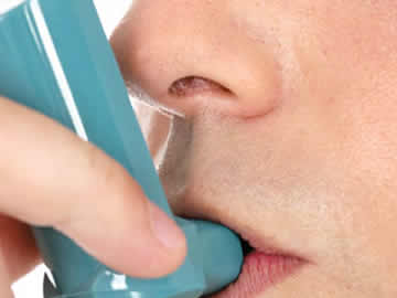 Allergies