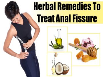 Anal Fissure