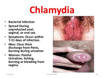 Chlamydia Infections