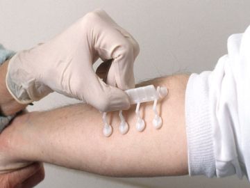 Tests and diagnosis