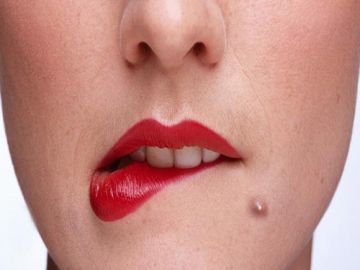 Pimple