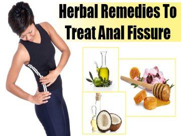 Anal Fissure