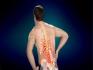 Backache