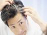 Graying of Hair